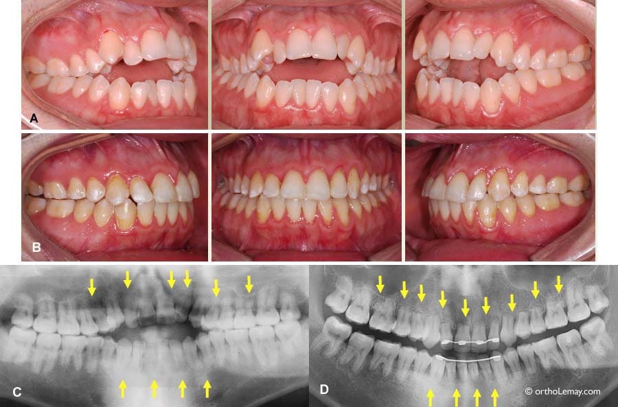 orthodontiste lyon 3 beance